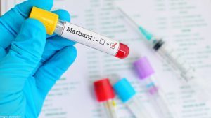 Vírus Marburg África: Segundo especialistas, risco de o vírus se espalhar pelo mundo é baixo. OMS alerta que doença tem uma taxa de mortalidade de até 88%, e não há vacina nem tratamento aprovado.