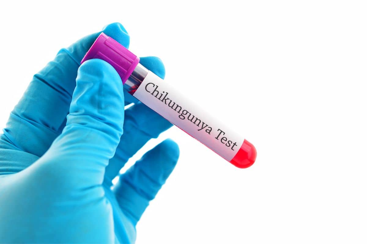 Agência reguladora dos Estados Unidos aprova vacina contra chikungunya do Butantan e da Valneva