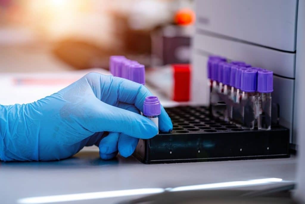Medição de ‘produtos químicos eternos’ em microamostras de sangue