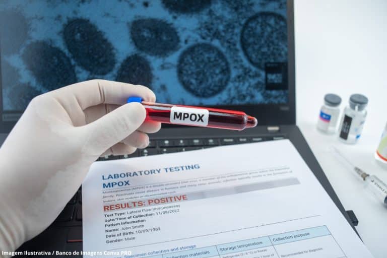 Surto de Mpox na África faz OMS declarar emergência global