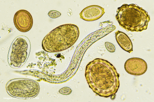 parasita